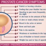 Prostate cancer: symptoms, risk factors, screening, diagnosis, complication, prevention and treatment