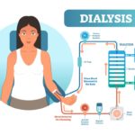 Dialysis in Nigeria: 2 types and costs