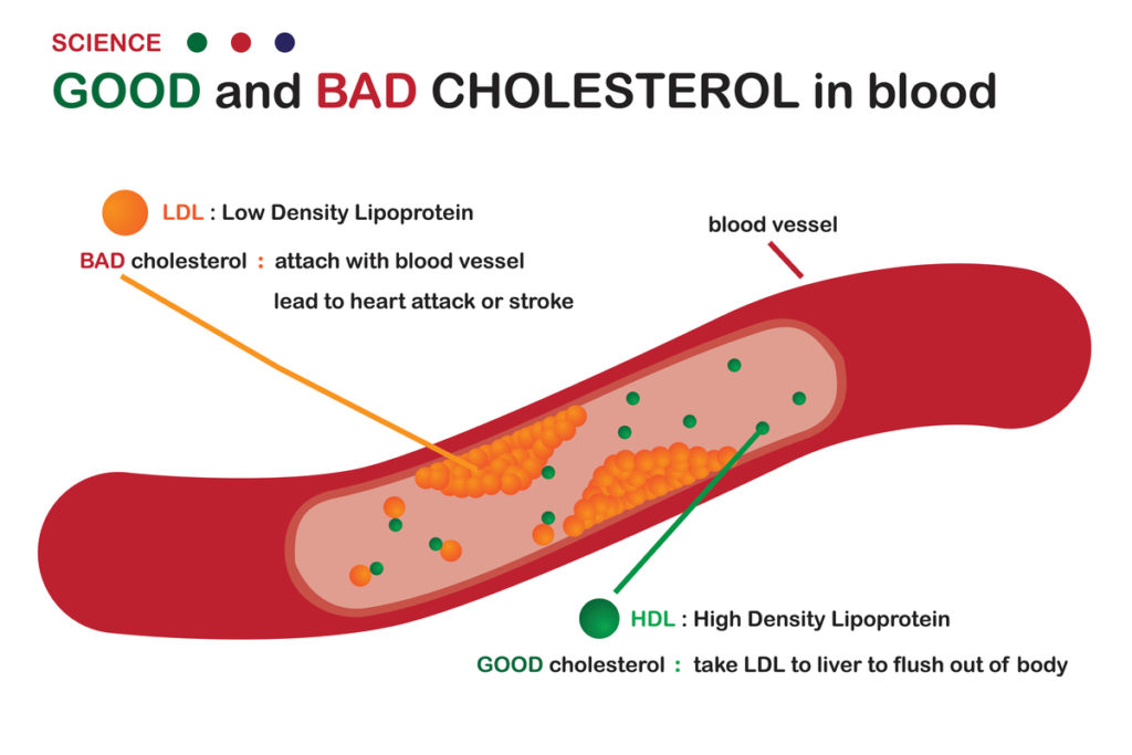 what is good and bad cholesterol