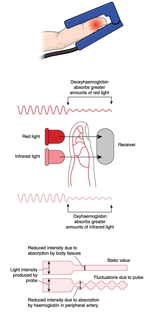 How a pulse oximeter works